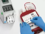 ¿Cuál es la tecnología RFID adecuada para las pulseras de los pacientes y las etiquetas de las bolsas de sangre? ¿UHF o HF?